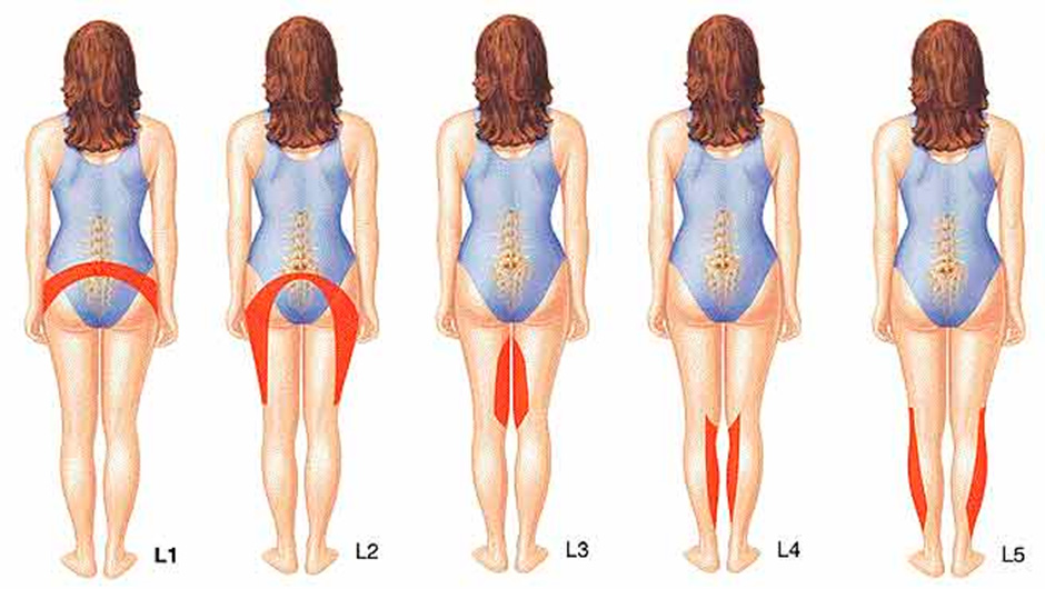 Болят ноги отдает в поясницу живот. Пояснично-крестцовый отдел позвоночника l5 s1. Гимнастика при протрузии l5-s1. Протрузия l5 s1 симптомы. Грыжа диска l5-s1 симптомы.